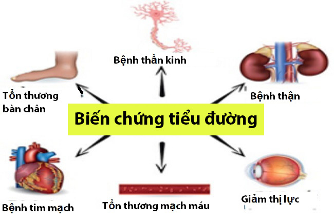 Biến chứng bệnh tiểu đường