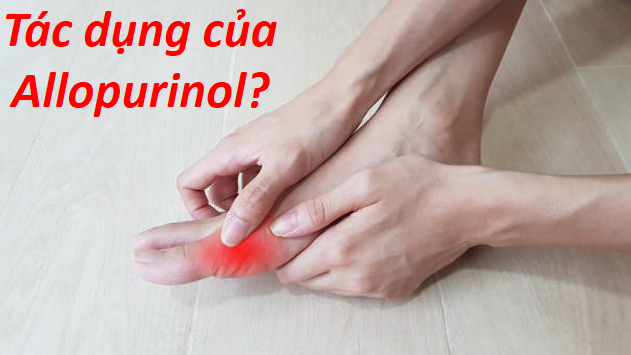 Tác dụng của Allo.purinol với người bệnh gút và những lưu ý khi sử dụng