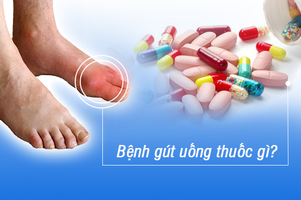 Bệnh gút uống thuốc gì?