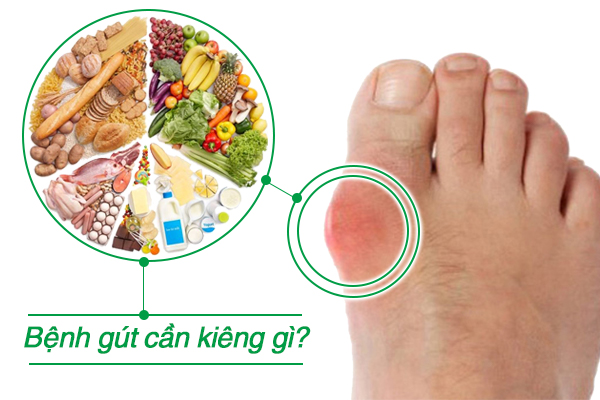 Bệnh gút cần kiêng gì?