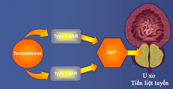  Nguyên nhân u xơ tiền liệt tuyến