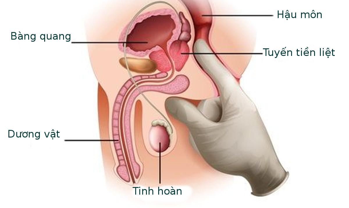 Thăm khám trực tràng bằng ngón tay