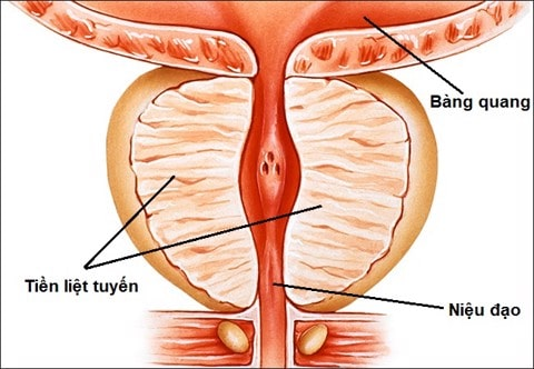 Kích thước tuyến tiền liệt bao nhiêu thì phải mổ? Giải pháp tối ưu cho bệnh nhân phì đại tuyến tiền liệt