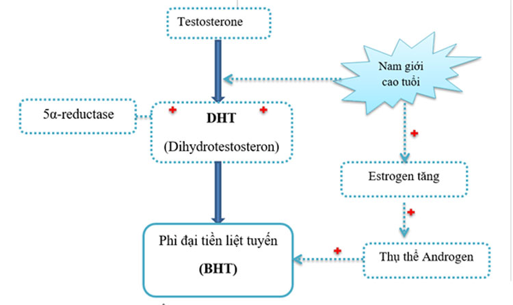 Nguyên nhân gây phì đại tuyến tiền liệt