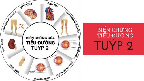 Các biến chứng của bệnh tiểu đường type 2?